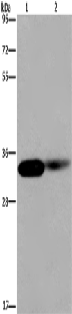 Western Blot analysis of Human kidney and Mouse lung tissue using LIMS1 Polyclonal Antibody at dilution of 1:200