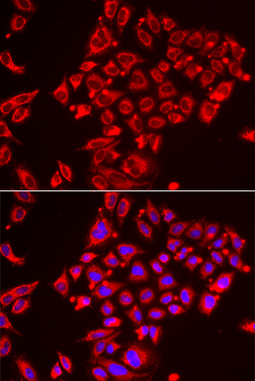 Immunofluorescence analysis of HeLa cells using ST3GAL3 Polyclonal Antibody