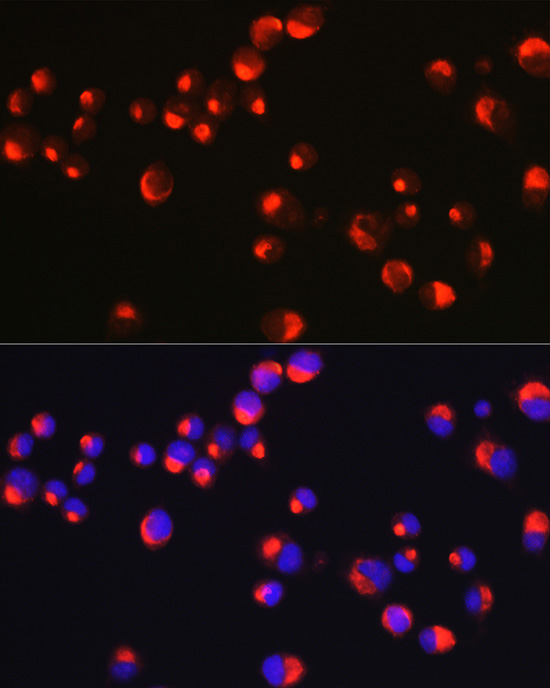 Immunofluorescence analysis of Neuro-2a cells using PRPH Polyclonal Antibody at dilution of 1:25 (40x lens). Blue: DAPI for nuclear staining.