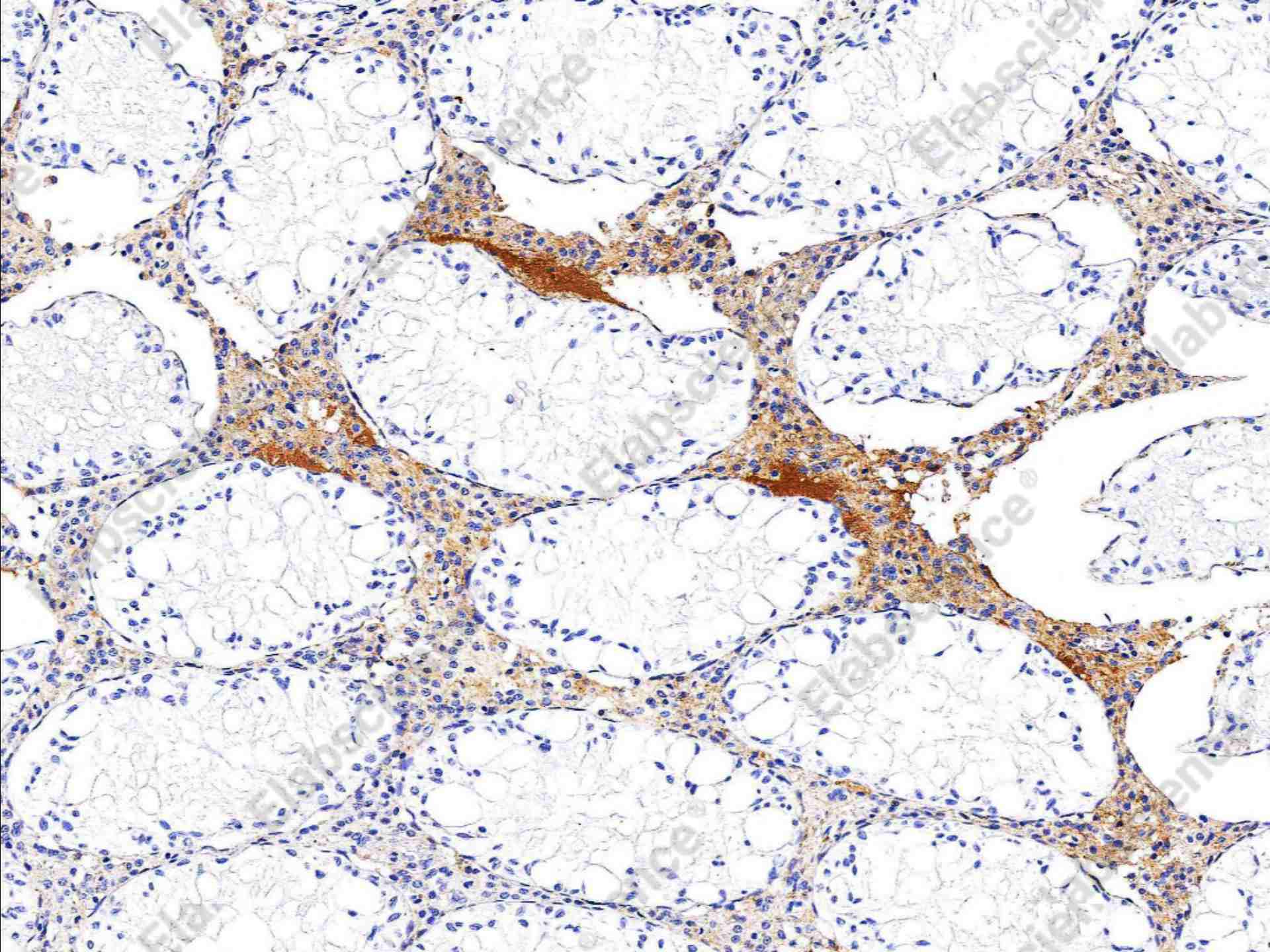 Recombinant CLEC3B/Tetranectin Monoclonal Antibody - 2