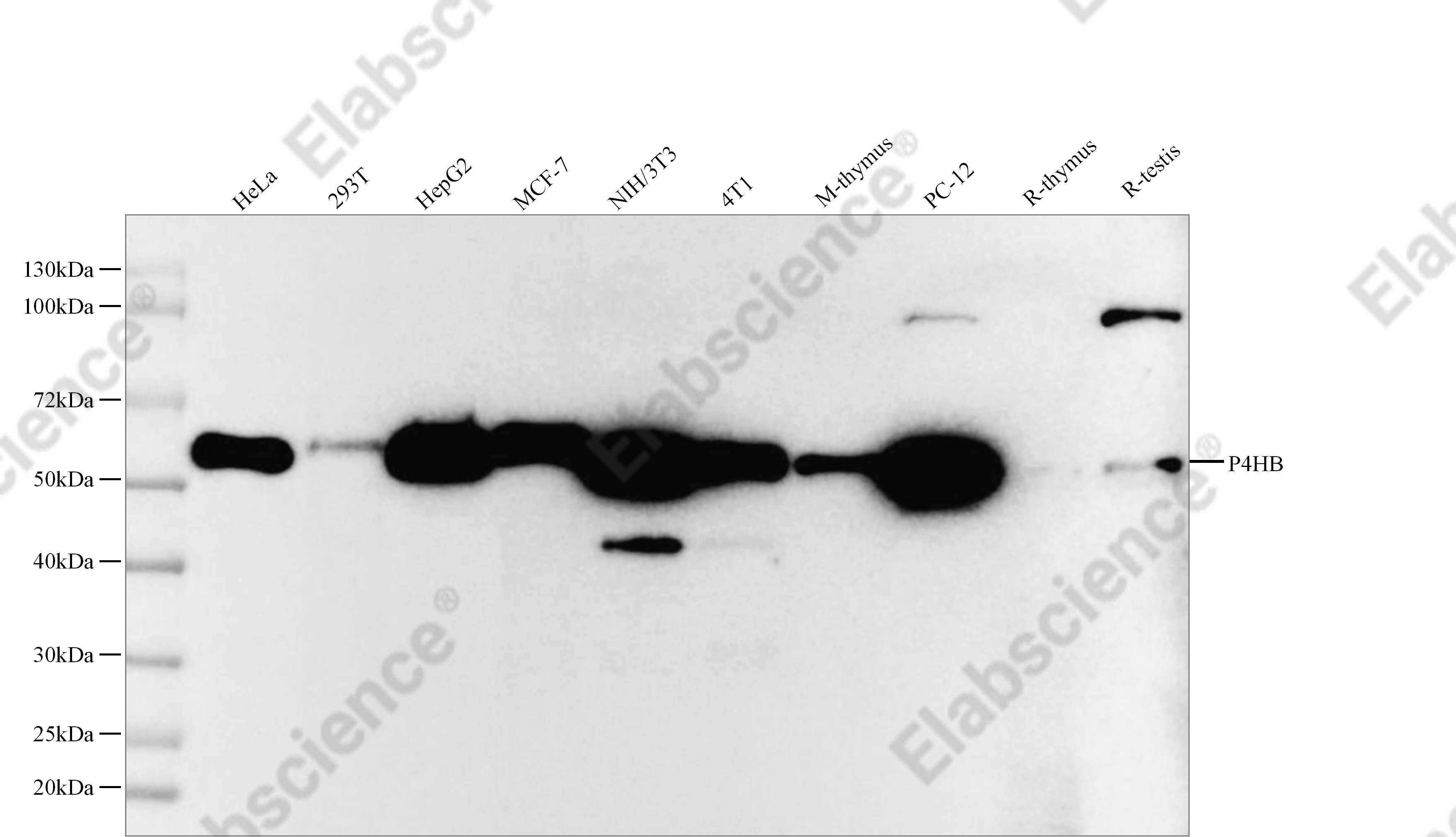Recombinant P4HB Monoclonal Antibody - 1