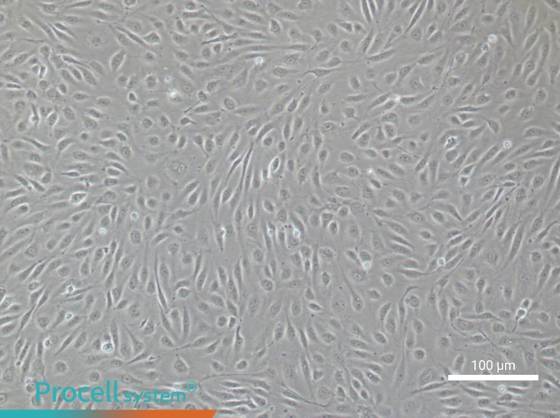 Human Cardiac Microvascular Endothelial Cell Complete Medium - 3