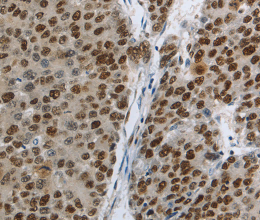 MCM3 Polyclonal Antibody - 2