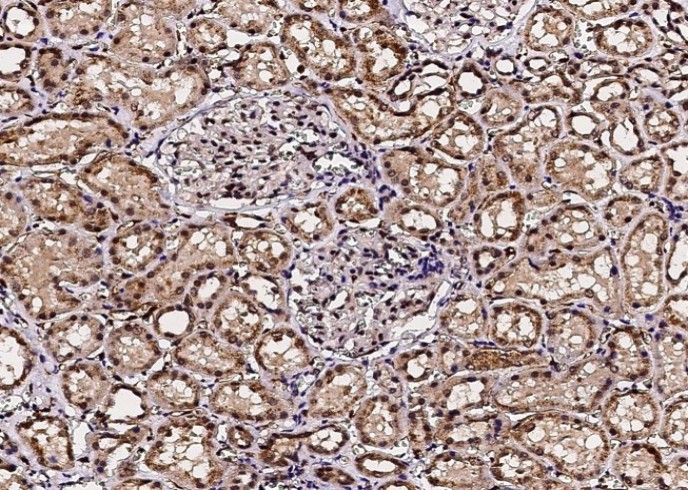 Recombinant ACOX1/AOX Monoclonal Antibody - small - 2