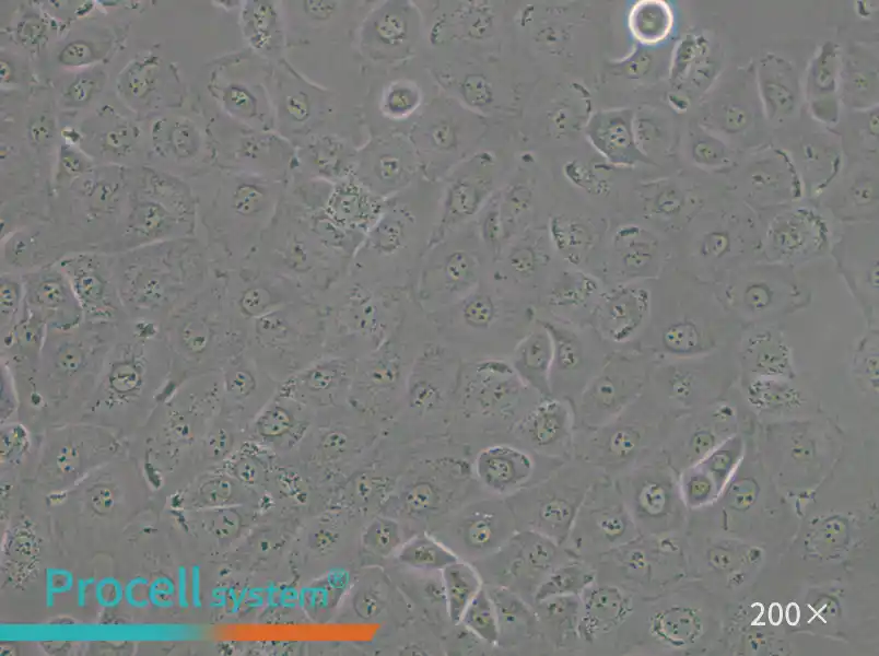 NIH:OVCAR-3 [OVCAR3] Cell Complete Medium - small - 4