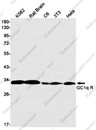 Recombinant GC1q R Monoclonal Antibody - 1