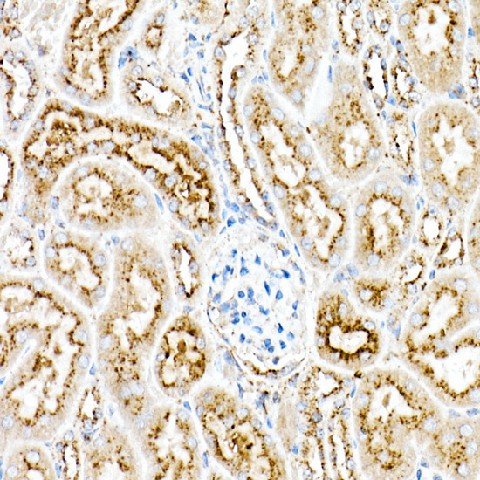 Immunohistochemistry of paraffin-embedded mouse kidney using [KO Validated] PSAP Polyclonal Antibody at dilution of 1:50 (40x lens).Perform high pressure a