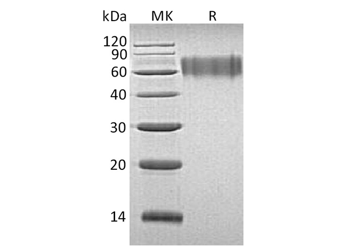 Recombinant Human LYPD3 Protein (His Tag)(Active)