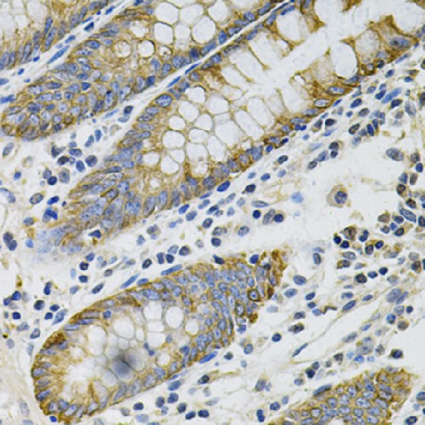 Immunohistochemistry of paraffin-embedded Human colon using KRT20 Polyclonal Antibody at dilution of 1:100 (40x lens).