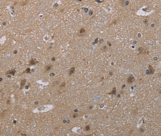 Immunohistochemistry of paraffin-embedded Human brain tissue using MAL Polyclonal Antibody at dilution 1:30