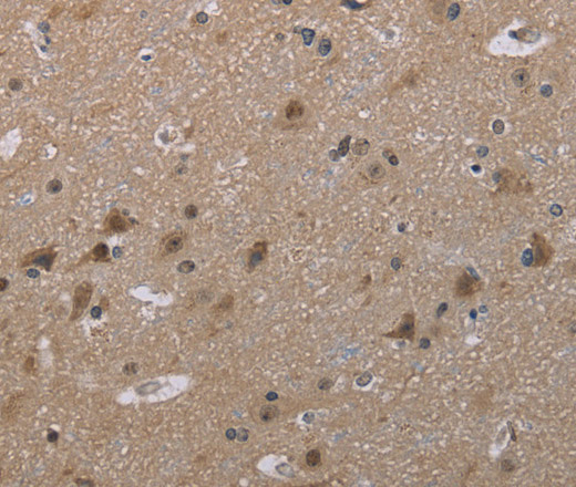 Immunohistochemistry of paraffin-embedded Human brain  tissue using MAL Polyclonal Antibody at dilution 1:30