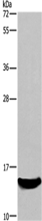 Western Blot analysis of Mouse kidney tissue using AIF1 Polyclonal Antibody at dilution of 1:500