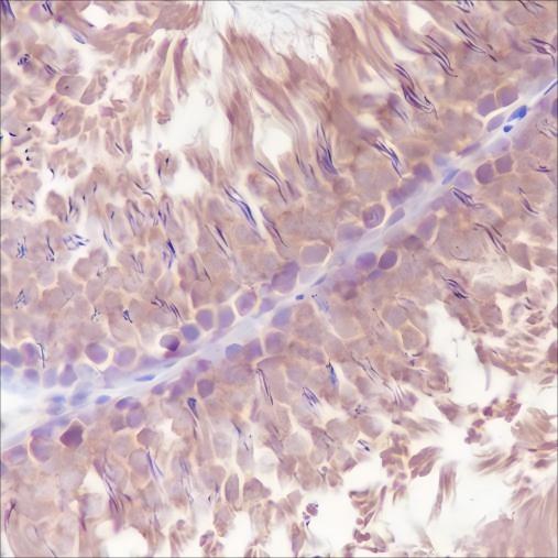 Recombinant LysRS Monoclonal Antibody - small - 4