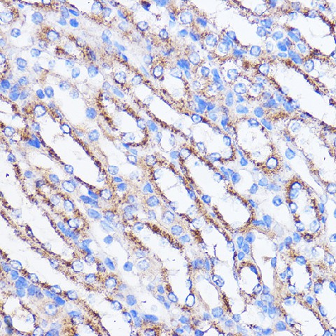 Immunohistochemistry of paraffin-embedded Mouse kidney using MIER1 Polyclonal Antibody at dilution of 1:100 (40x lens).Perform microwave antigen retrieval with 10 mM PBS buffer pH 7.2 before commencing with IHC staining protocol.