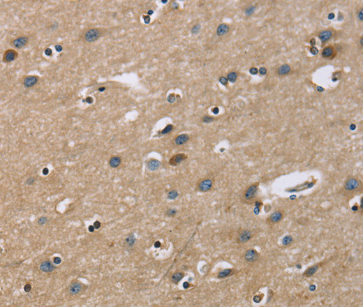 Immunohistochemistry of paraffin-embedded Human brain  tissue using GAB1 Polyclonal Antibody at dilution 1:40