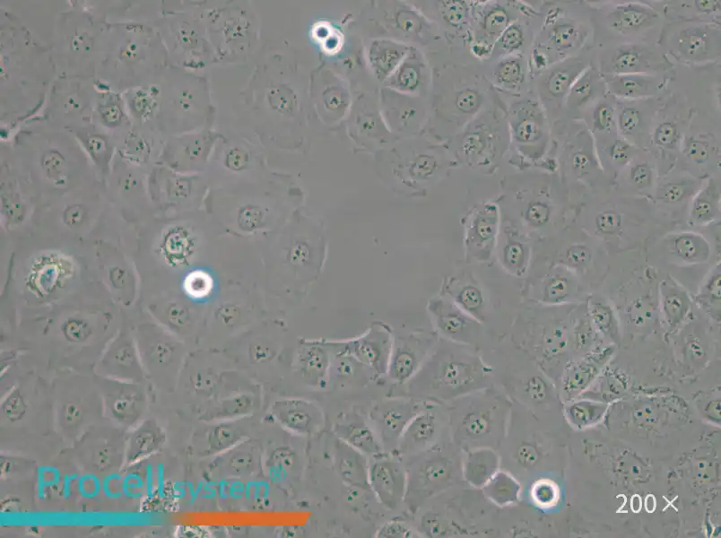 NIH:OVCAR-3 [OVCAR3] Cell Complete Medium - small - 6