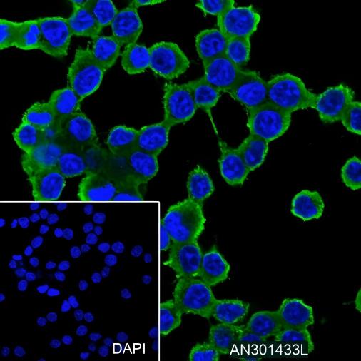Recombinant alpha Actinin 4 Monoclonal Antibody - small - 4