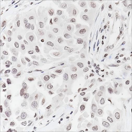 Recombinant Histone H3 (Mono Methyl Lys79) Monoclonal Antibody - 2