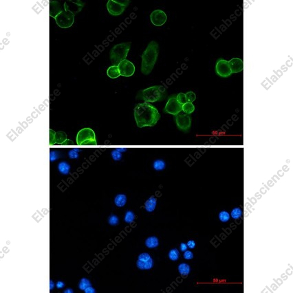 Recombinant EpCAM/TROP-1/TACSTD1 Monoclonal Antibody - 4