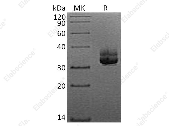 Recombinant Human Langerin/CD207 Protein (His Tag) - 1