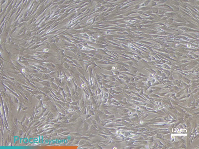Human Uterine Fibroblast Complete Medium - 3