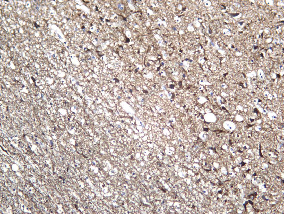 Recombinant Internexin α Monoclonal Antibody - 2