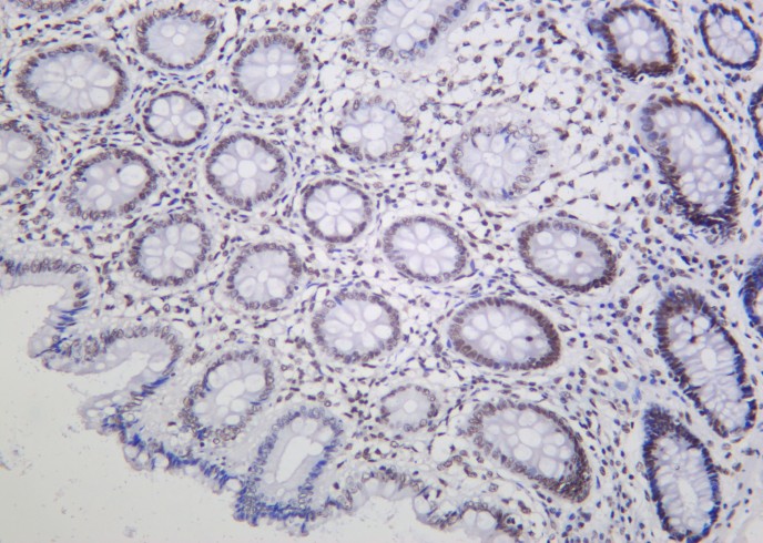 Recombinant SMC3 Monoclonal Antibody - small - 2