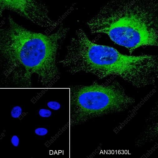 Recombinant PI3 Kinase p110 alpha Monoclonal Antibody - 7