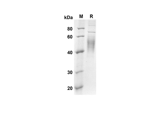 Recombinant Mouse GM-CSF Protein(His Tag)-产品推荐-1