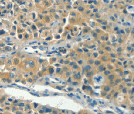 KLC1 Polyclonal Antibody - 3