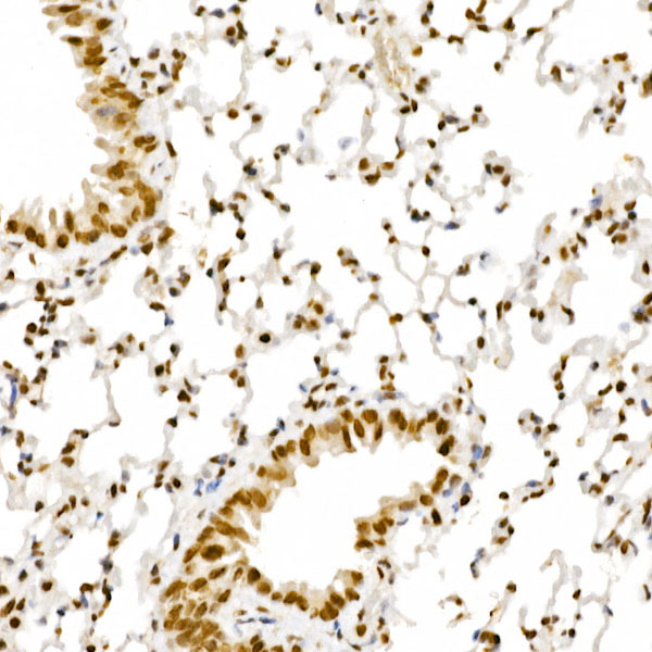 Immunohistochemistry of paraffin-embedded mouse lung using ALKBH5 Polyclonal Antibody at dilution of 1:100 (40x lens).Perform high pressure antigen retrieval with 10 mM citrate buffer pH 6.0 before commencing with IHC staining protocol.