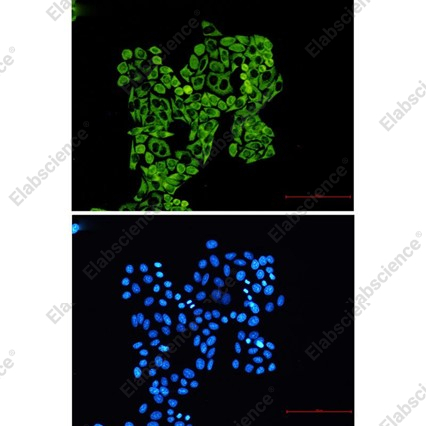 Recombinant RPS8 Monoclonal Antibody - 4
