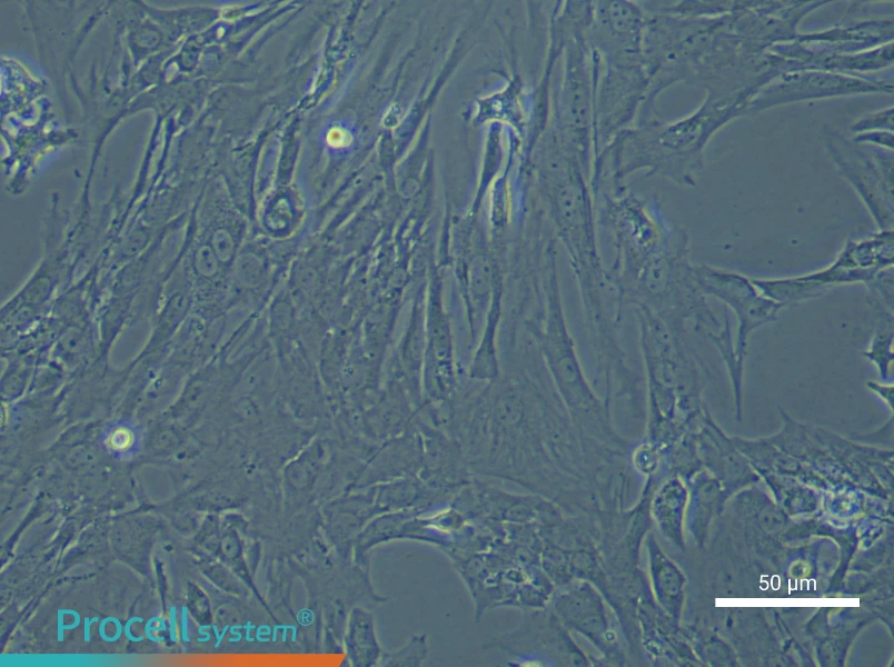 Mouse Microvascular Pericyte Complete Medium - small - 6