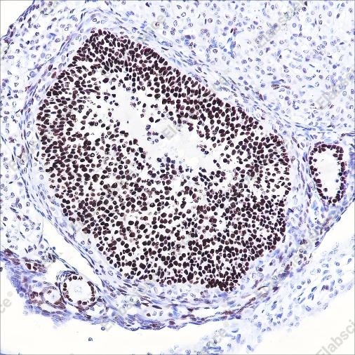 Recombinant FOXL2 Monoclonal Antibody - 3