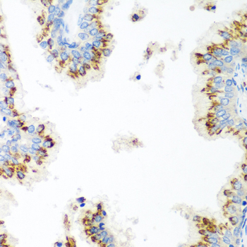 Immunohistochemistry of paraffin-embedded human prostate using UBIAD1 Polyclonal antibody at dilution of 1:100 (40x lens).Perform microwave antigen retrieval with 10 mM PBS buffer pH 7.2 before commencing with IHC staining protocol.