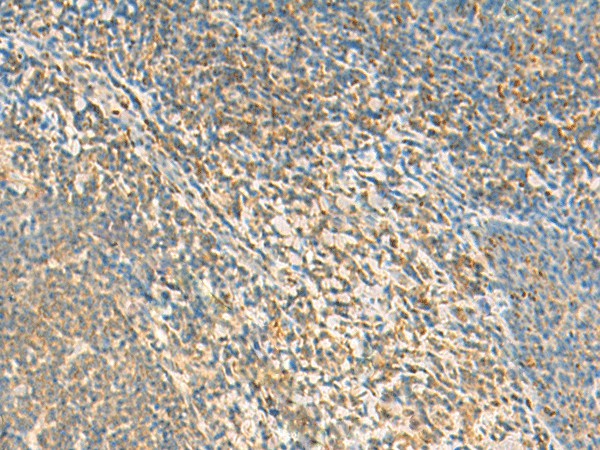 Immunohistochemistry of paraffin-embedded Human tonsil tissue  using TXNDC12 Polyclonal Antibody at dilution of 1:50(?200)