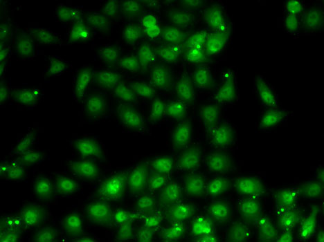 Immunofluorescence analysis of MCF7 cells using MBNL1 Polyclonal Antibody