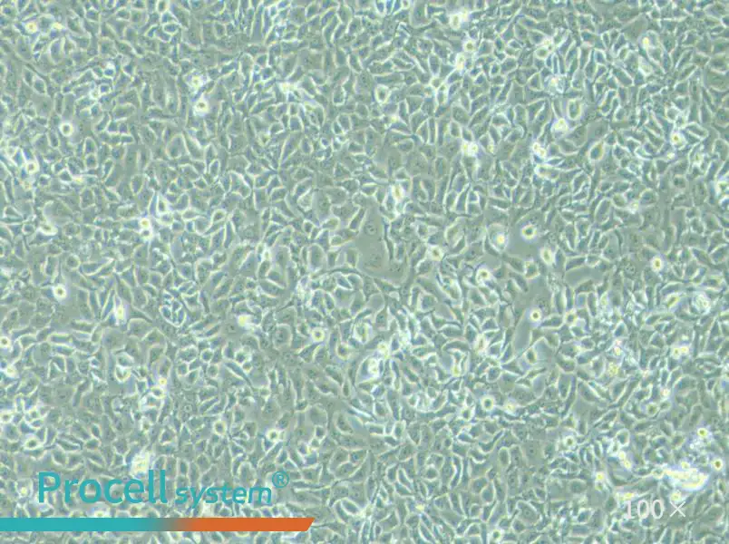 KYSE-450 Cell Complete Medium - 2