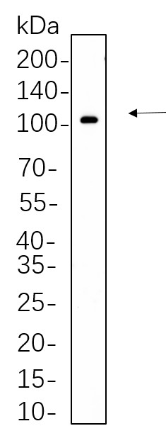 Recombinant Phospho-STAT5 (Tyr694) Monoclonal Antibody-searchlist-1