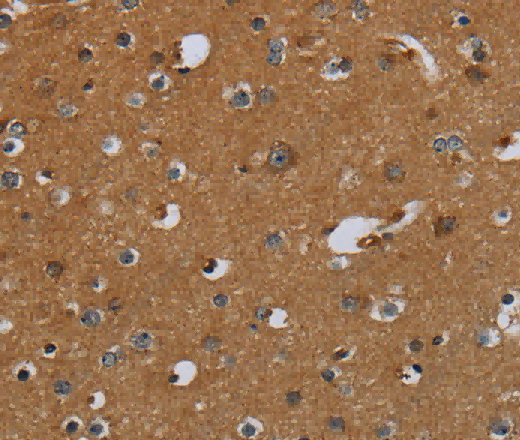 PCK2 Polyclonal Antibody - 2