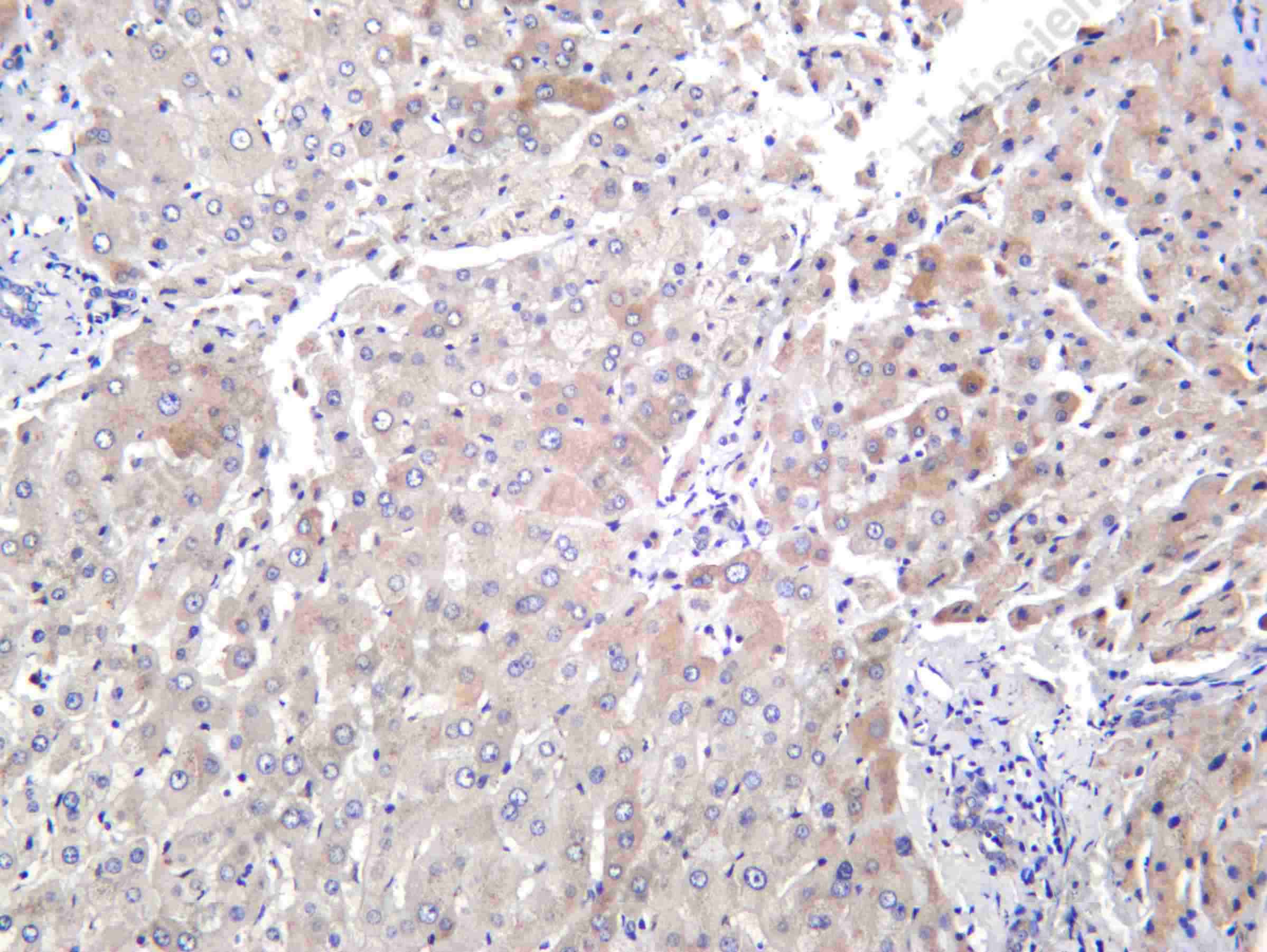 Recombinant RIPK1 (Phospho Ser166) Monoclonal Antibody - 1