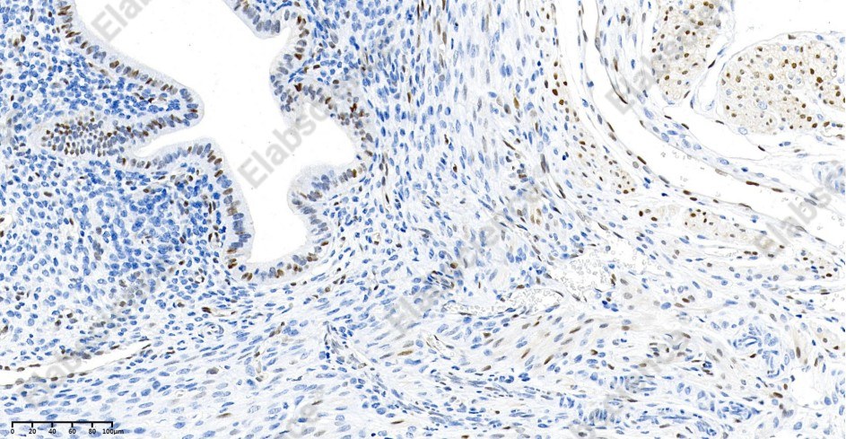 Recombinant Cyclin D1 Monoclonal Antibody - 4