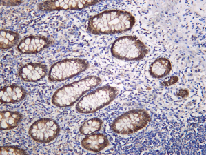 Recombinant EVI1 Monoclonal Antibody - 1