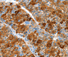 ALDOB Polyclonal Antibody - 2