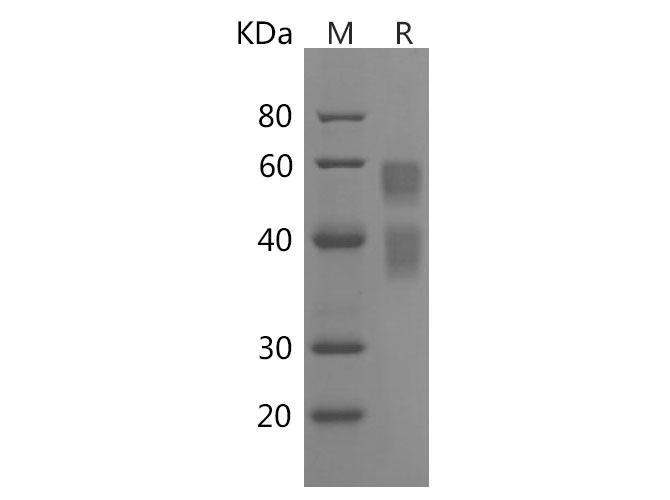Recombinant Mouse Il17F Protein(Sumo Tag)-产品推荐-1