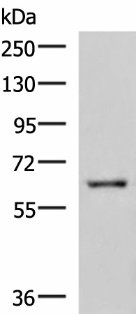 Western blot analysis of HepG2 cell lysate  using LILRB5 Polyclonal Antibody at dilution of 1:600