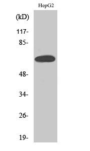 Western Blot analysis of HepG2 cells using ER alpha Polyclonal Antibody at dilution of 1:500.