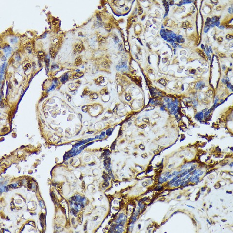 Immunohistochemistry of paraffin-embedded Human placenta using DAPK3 Polyclonal Antibody at dilution of 1:100 (40x lens).