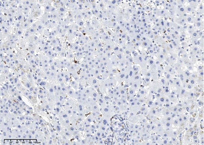 LYZ Monoclonal Antibody-searchlist-1