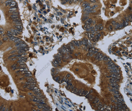 GLUL Polyclonal Antibody - 2
